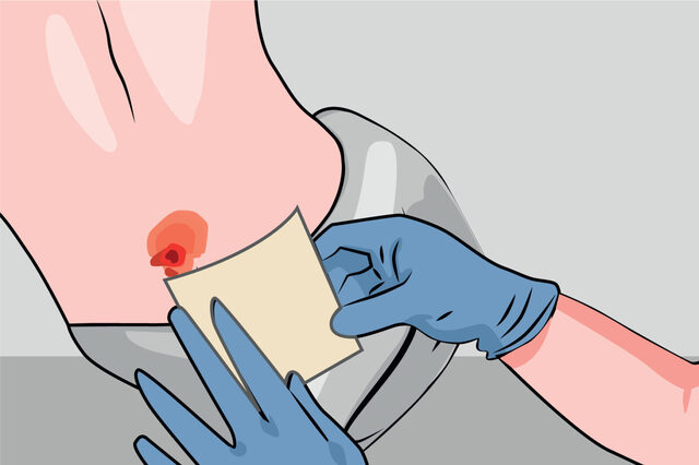 Wound Care.jpg